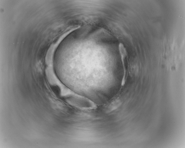 X0000088611010200706151821