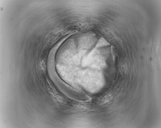 X0000088611010200706221425