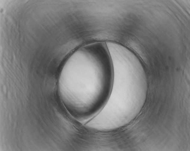 X0000088620164200705250931