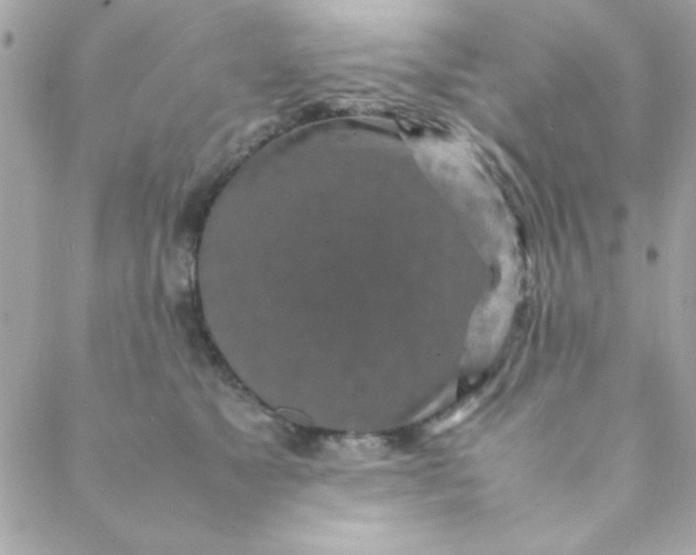 X0000088620517200706151855