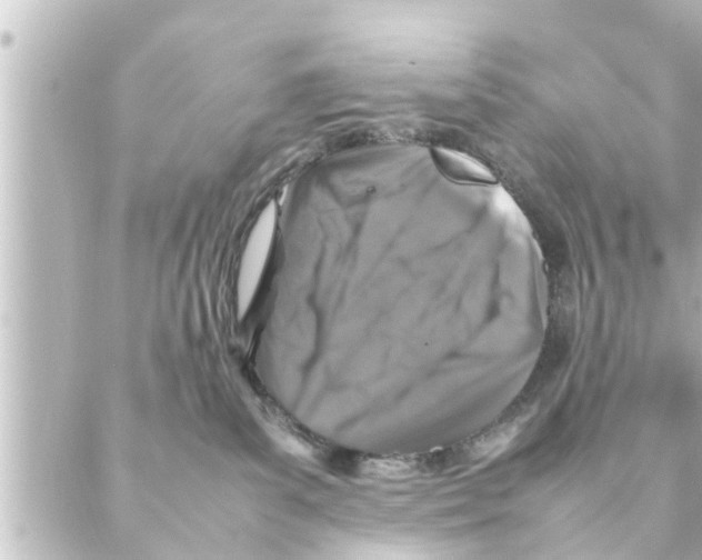 X0000088620139200706221505