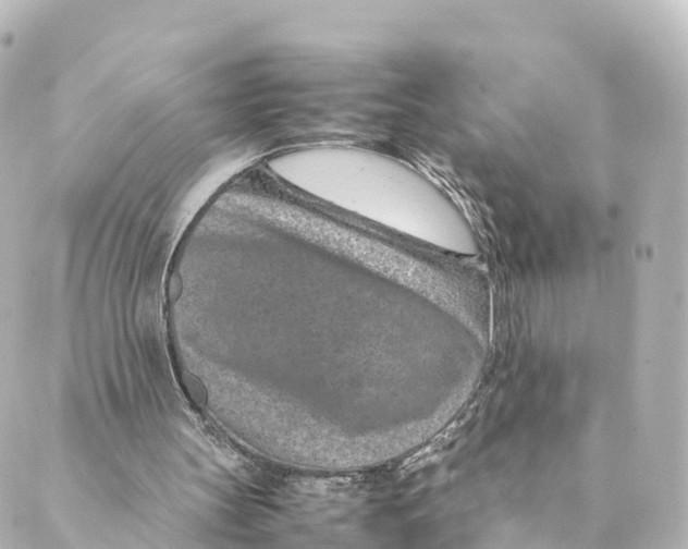 X0000088620147200706221504