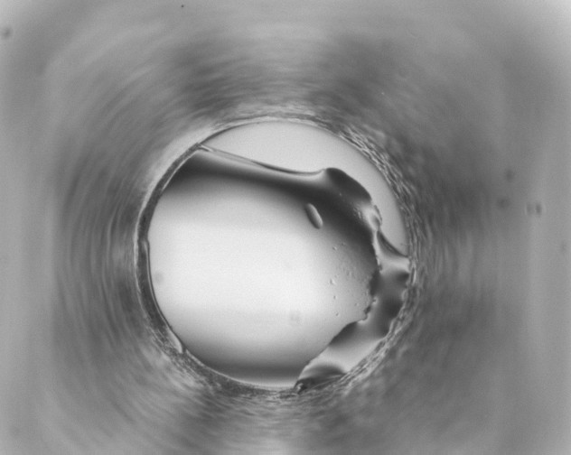 X0000088620148200706221504