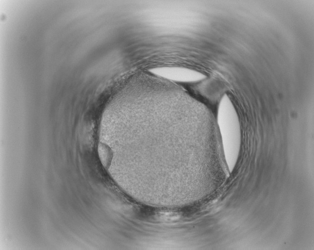 X0000088620319200706221502