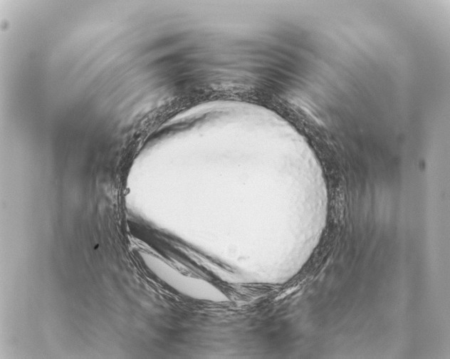 X0000088620917200706221451