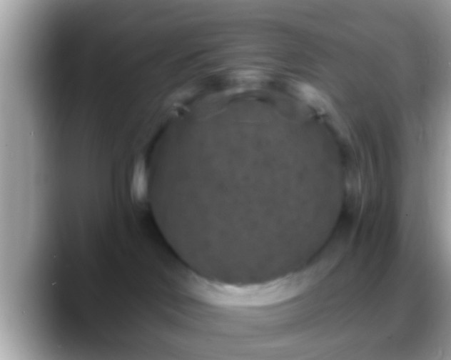 X0000088630046200706011152