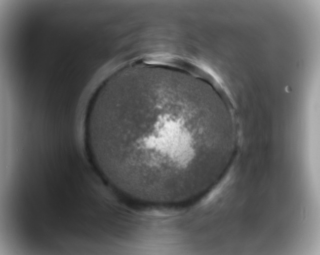 X0000088630199200706011150