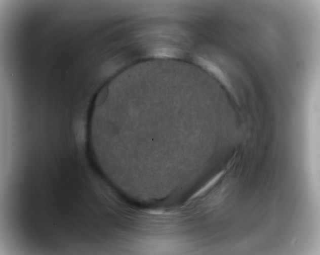 X0000088630299200706011149