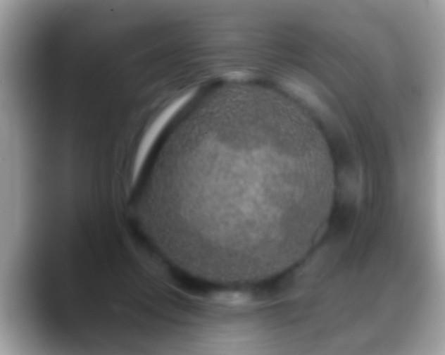 X0000088630358200706011149