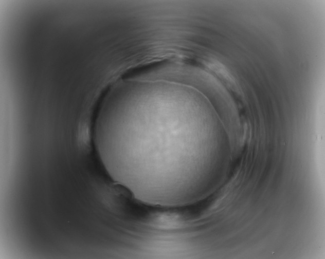 X0000088630500200706011147