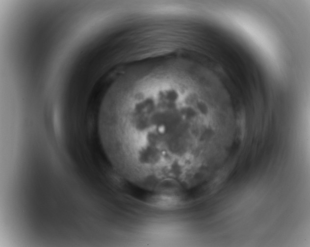 X0000088630765200706011144