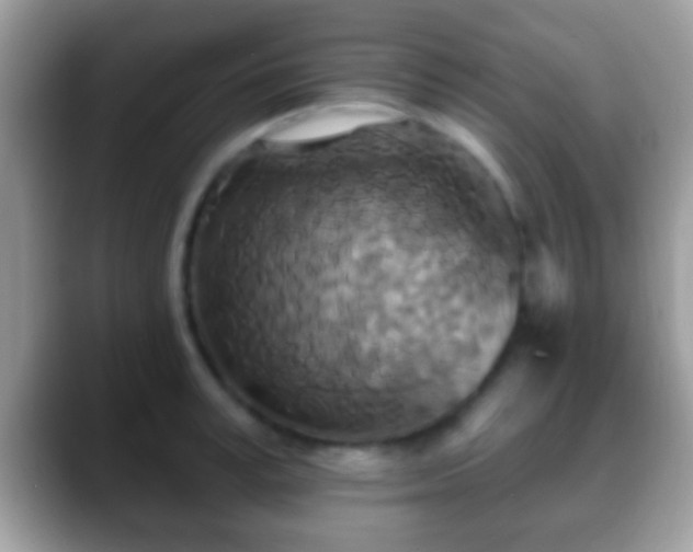 X0000088630995200706011141