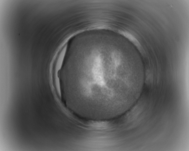 X0000088631039200706011141