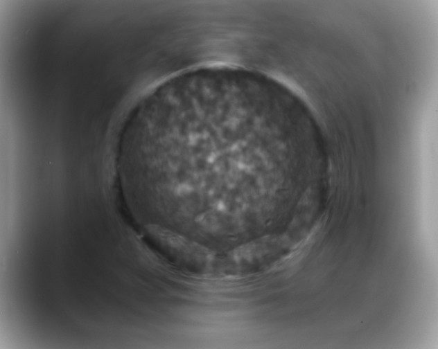 X0000088631359200706011137