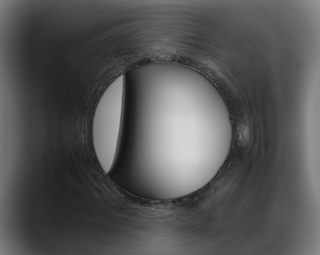 X0000088640964200705250915