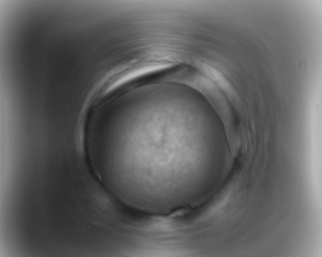 X0000088640391200706011207