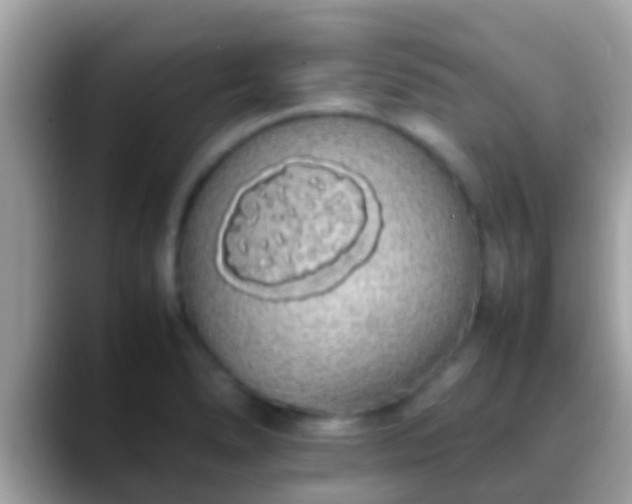X0000088641278200706011156