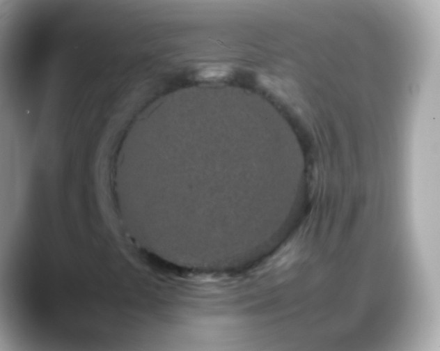 X0000088641441200706011154