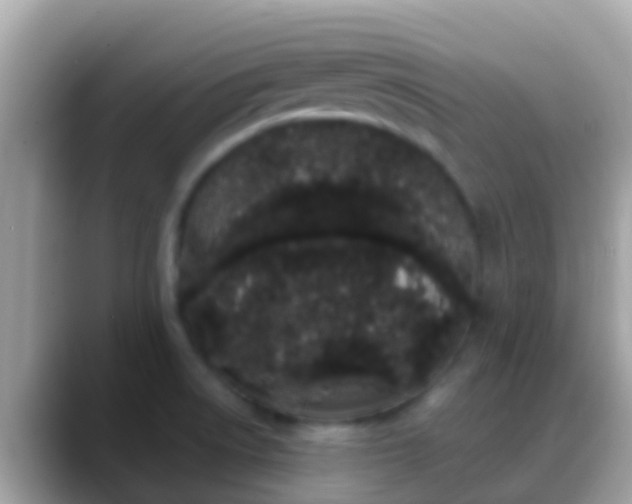 X0000088641522200706011153