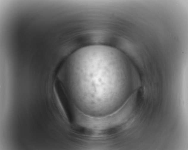 X0000088650164200706011227