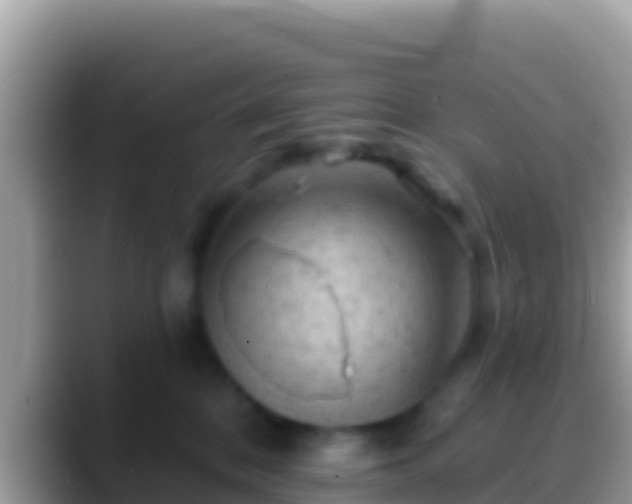 X0000088650328200706011225