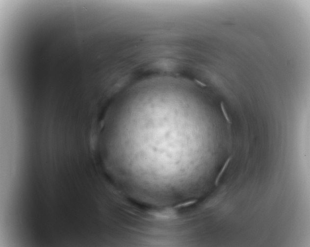 X0000088650576200706011223