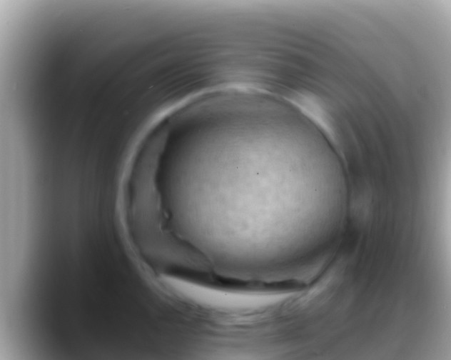 X0000088651144200706011216
