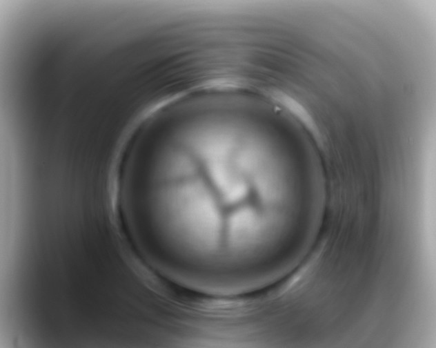 X0000088651179200706011215