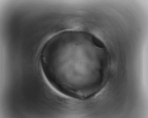 X0000088651455200706011212