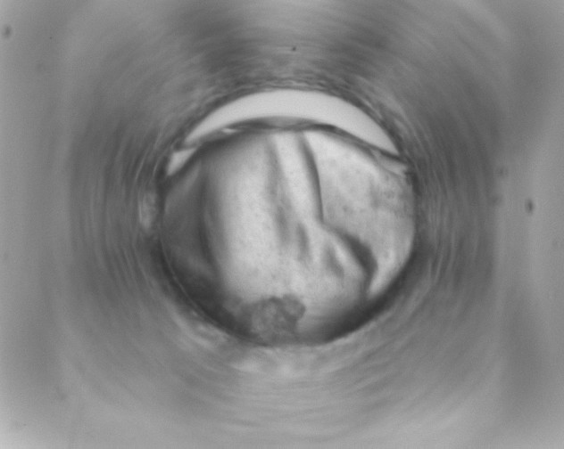 X0000088650033200706152018