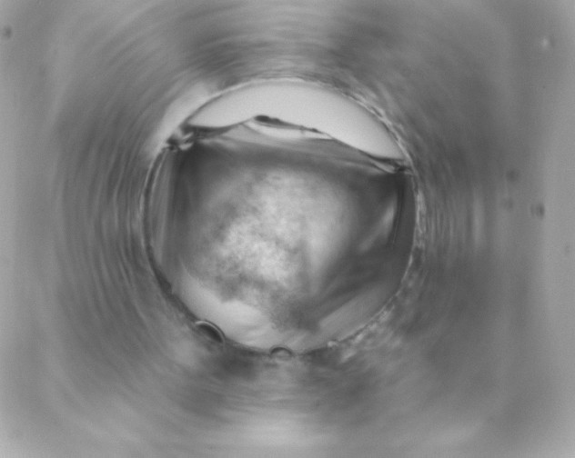 X0000088650099200706152017