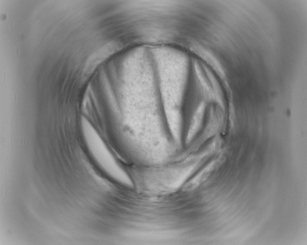 X0000088650105200706152017