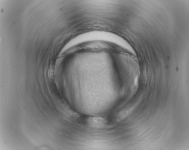 X0000088650137200706152017