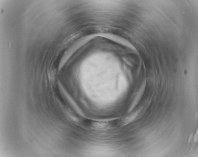 X0000088650139200706152017