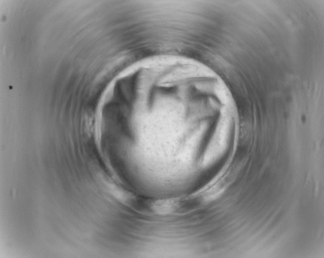 X0000088650142200706152017