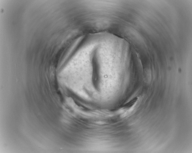 X0000088650184200706152017