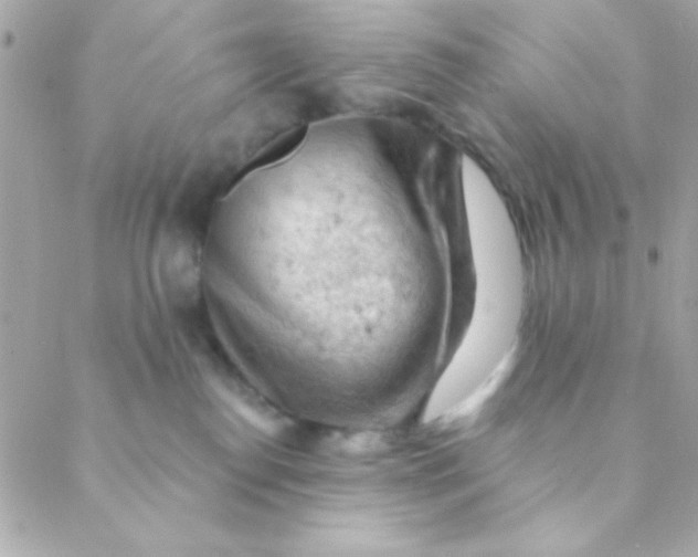 X0000088650186200706152017