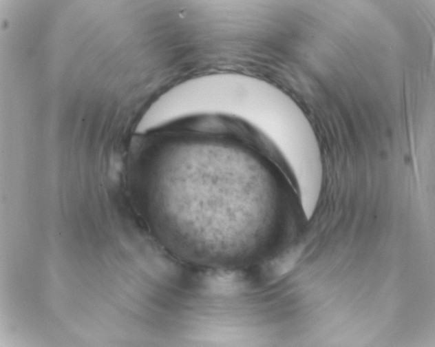 X0000088650235200706152015