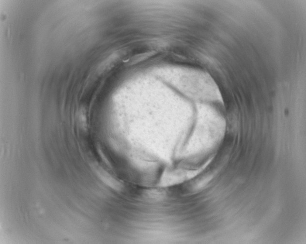 X0000088650238200706152015