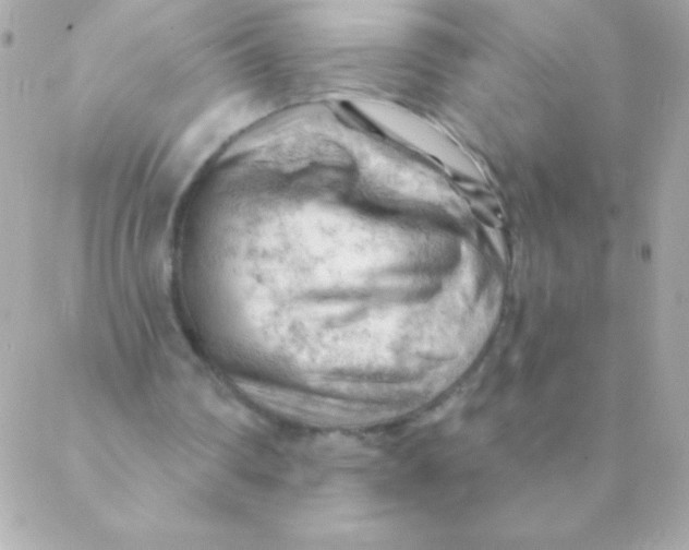 X0000088650290200706152014