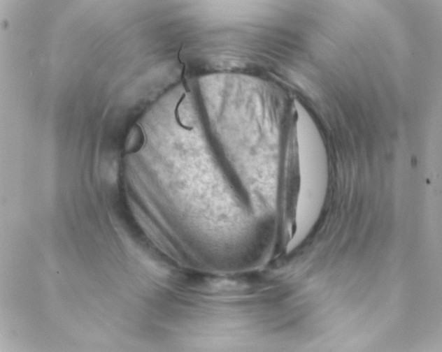 X0000088650315200706152014