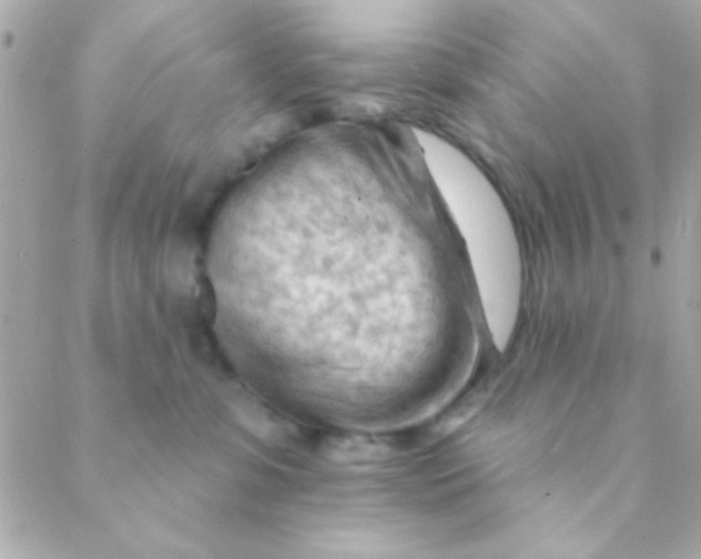 X0000088650331200706152014