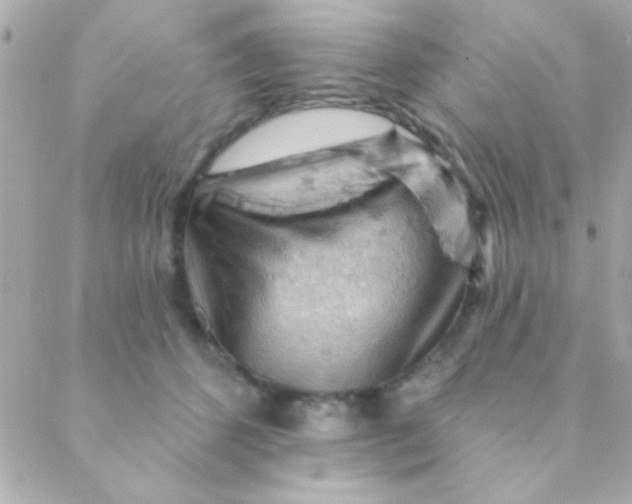 X0000088650512200706152011