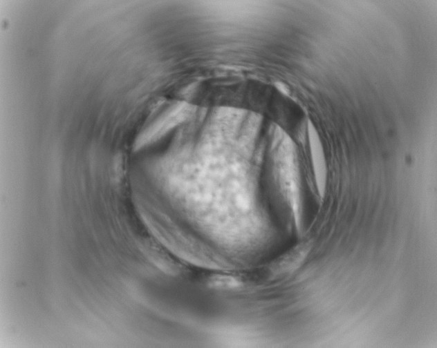 X0000088650519200706152011