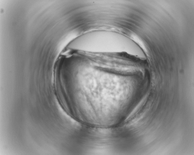 X0000088651095200706152001