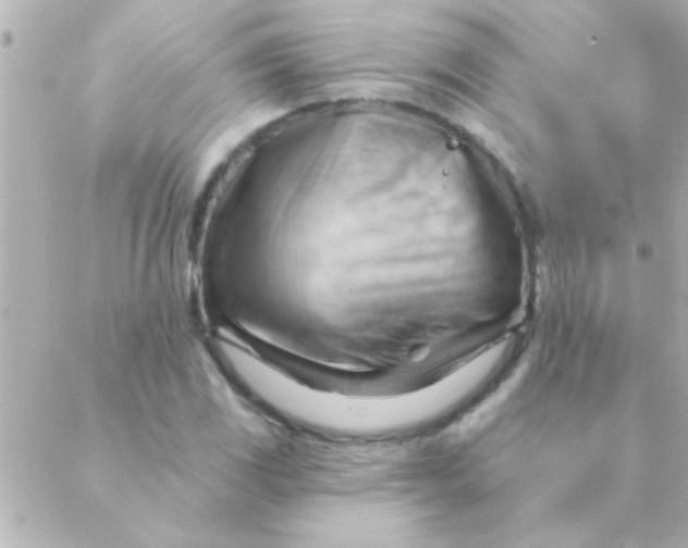 X0000088651117200706152000