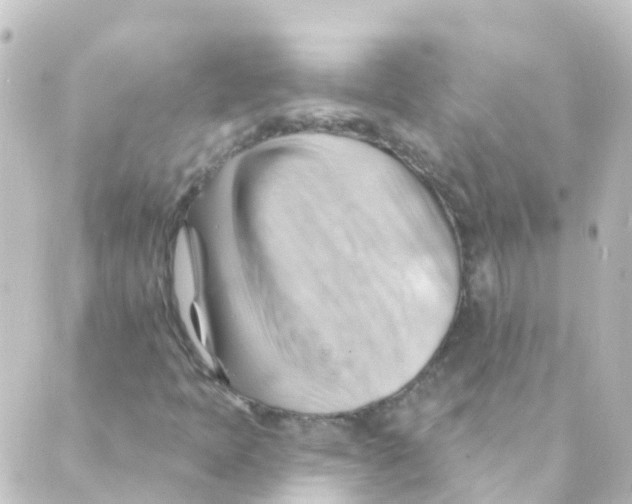 X0000088651397200706221559