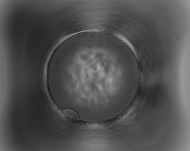 X0000088661099200705251517