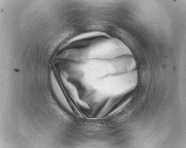 X0000088660729200706152032