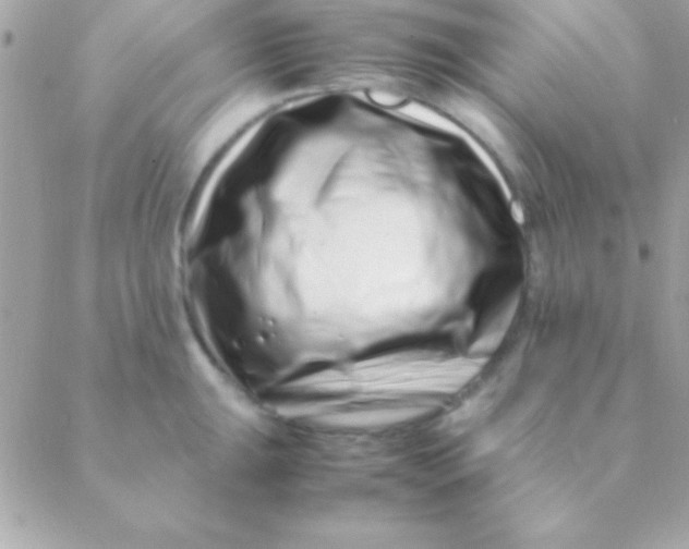 X0000088661047200706152027